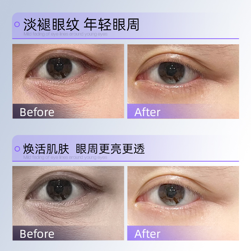 多肽抗皱眼部精华液